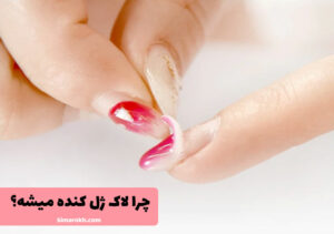 چرا لاک ژل کنده میشه