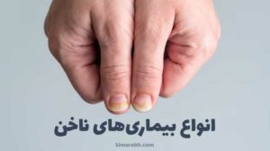 عکس انواع بیماری های ناخن